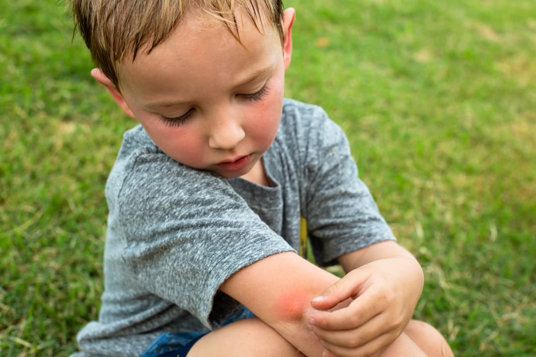 Young boy with a bug bite in the garden